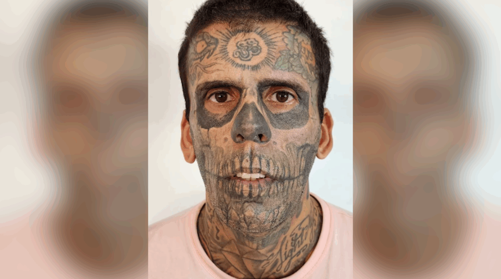 tatoeage verwijderen